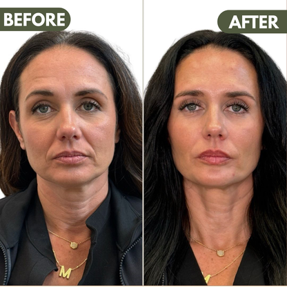 LymiGlow Sculpting Face Brush™