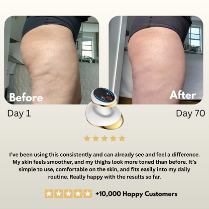 SilkTone Body Revive & Sculpt Home Massager