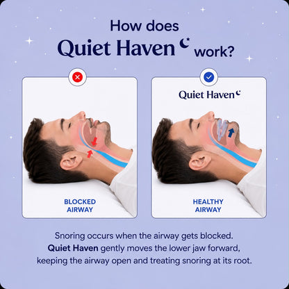 Quiet Haven™ Anti-Snoring Mouthpiece