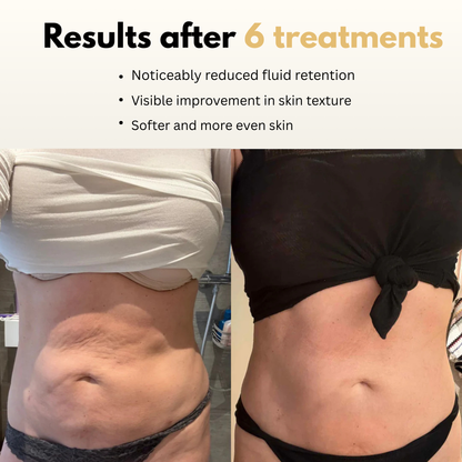 SilkTone Body Revive & Sculpt Home Massager