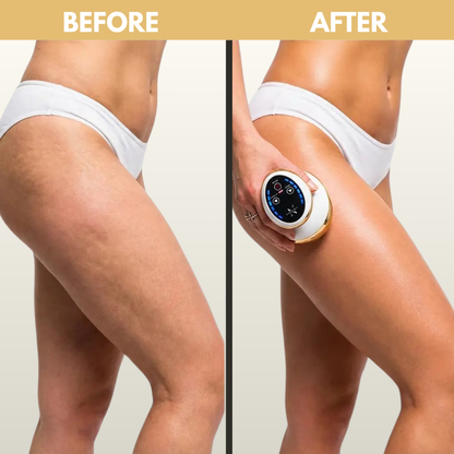 SilkTone Body Revive & Sculpt Home Massager