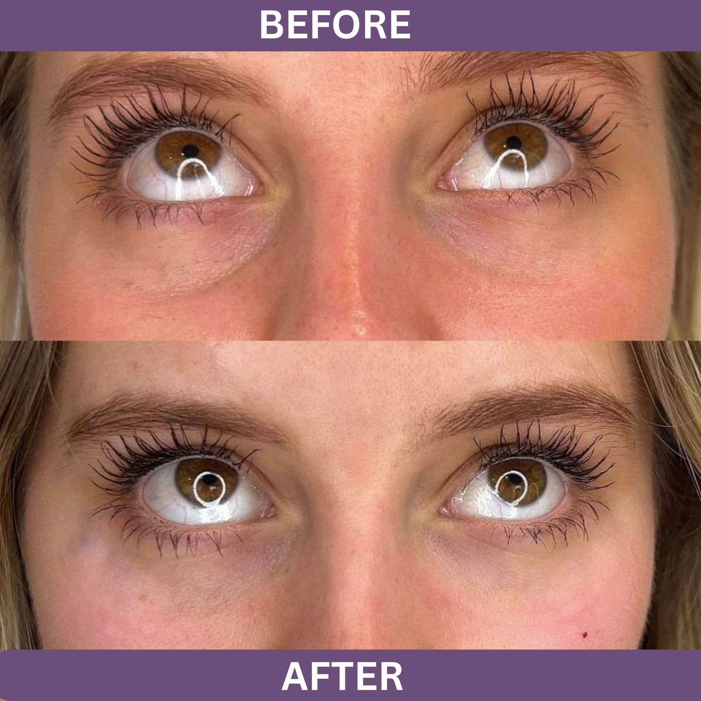 LumiEyes™