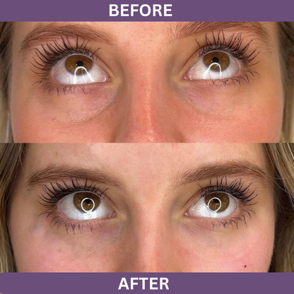 LumiEyes™