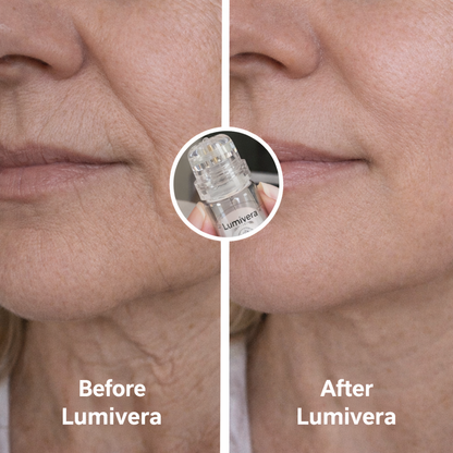 Lumivera Microneedling Infusion Kit