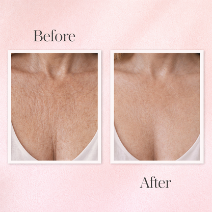 Lumivera Microneedling Infusion Kit