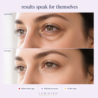 LumiEyes™