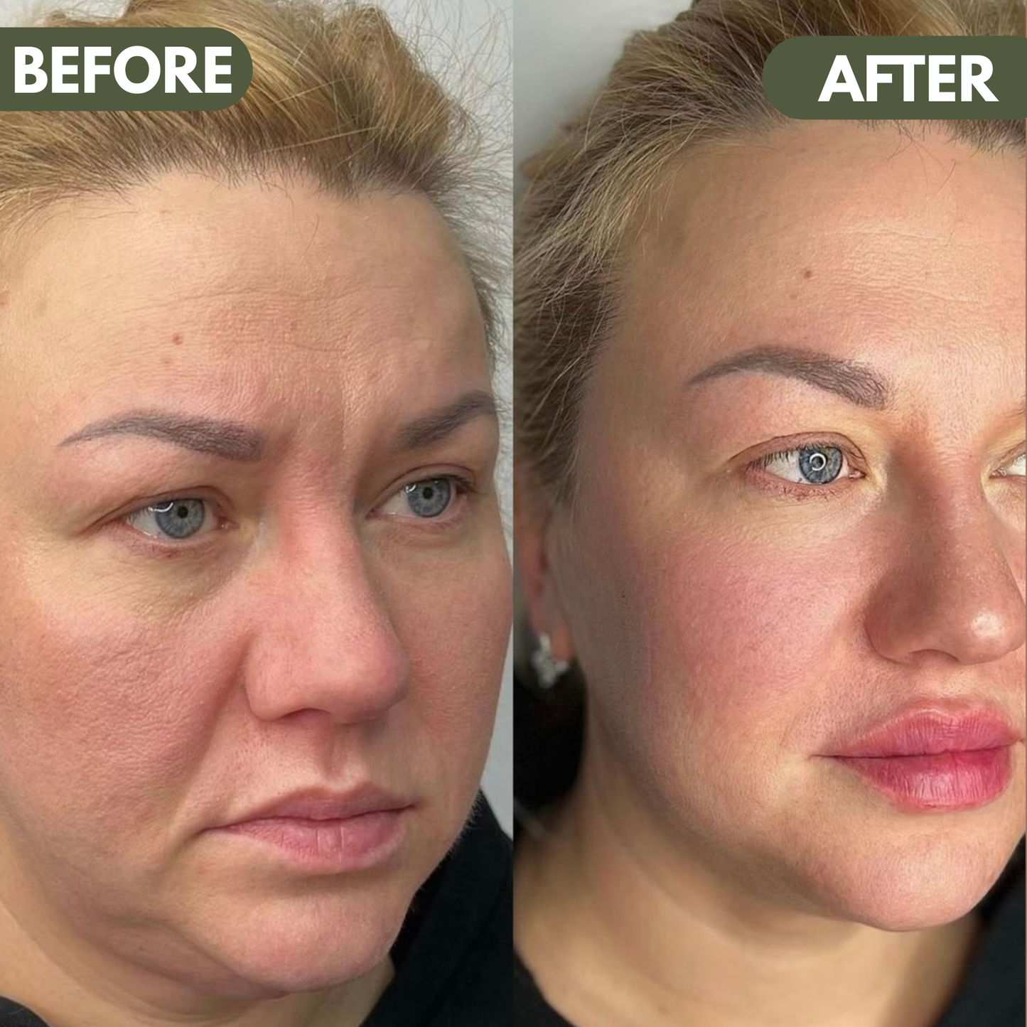 LymiGlow Sculpting Face Brush™